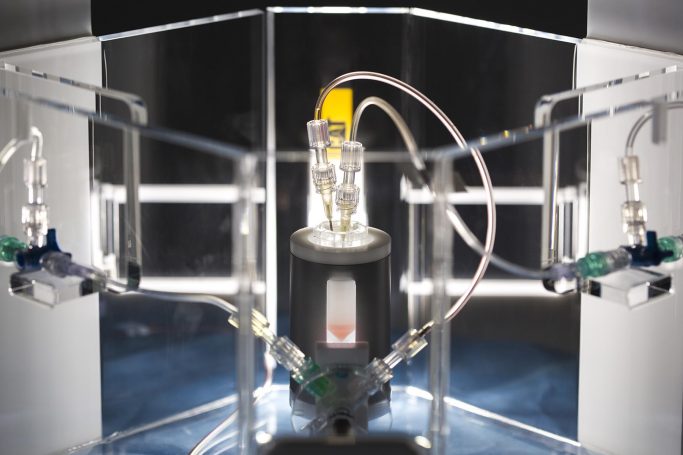 Medische fotografie van de Quirem Spheres microspheres, een medisch apparaat voor radioembolisatie.